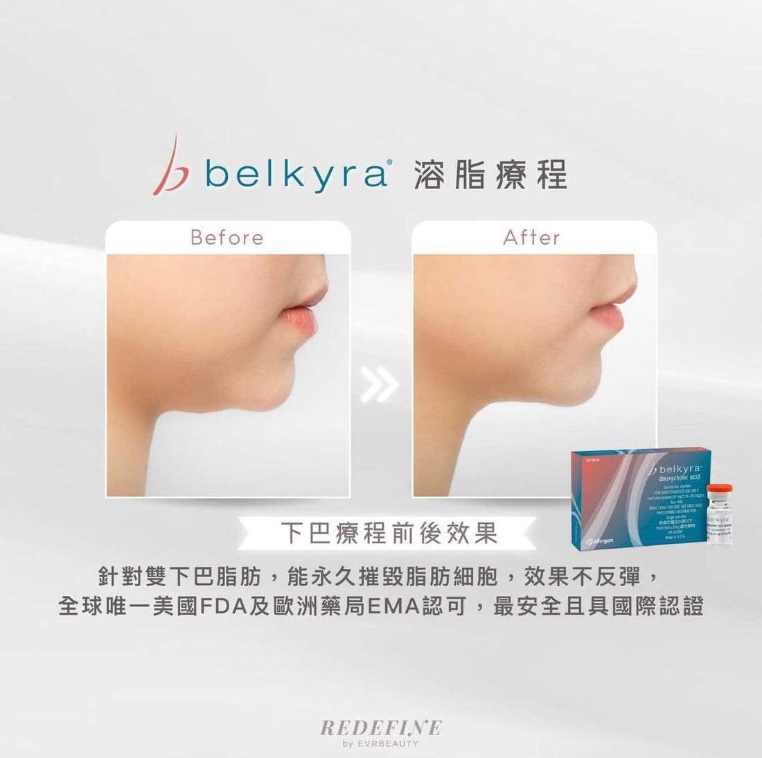 【新客限定】BELKYRA®溶脂針