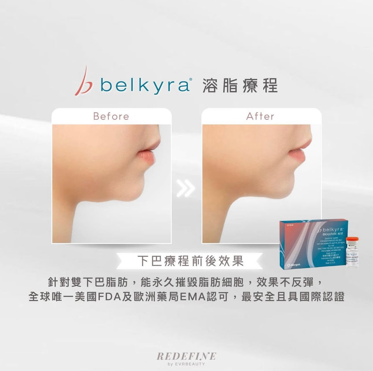 【新客限定】BELKYRA®溶脂針