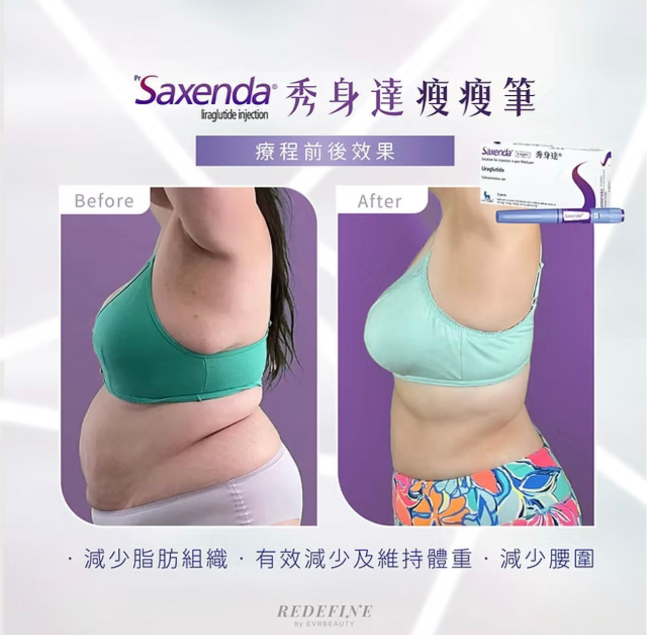 【新客限定】SAXENDA®瘦身筆