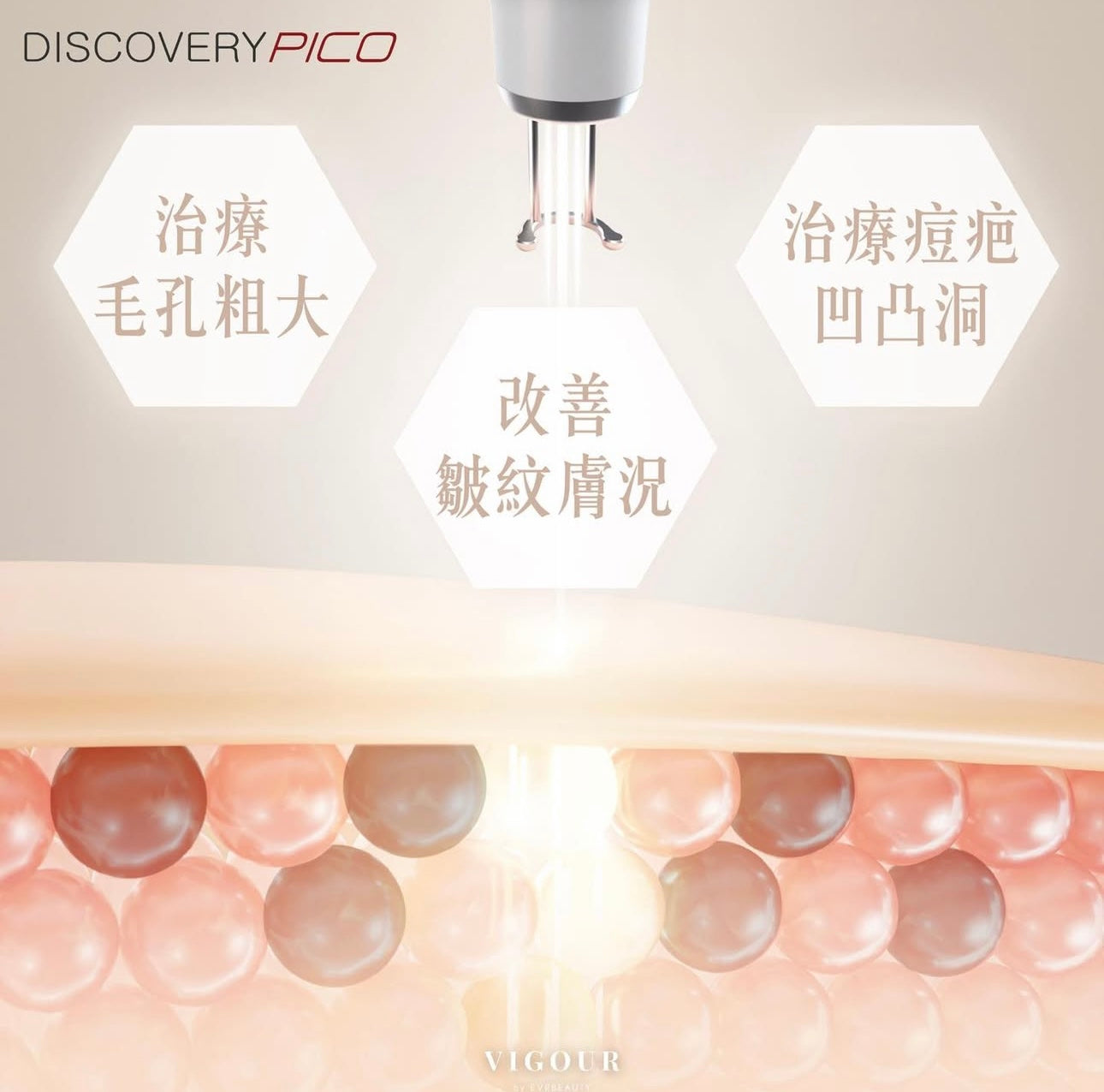 【美白去斑】PICO 1064nm 皮秒美白去斑激光 新客首次優惠