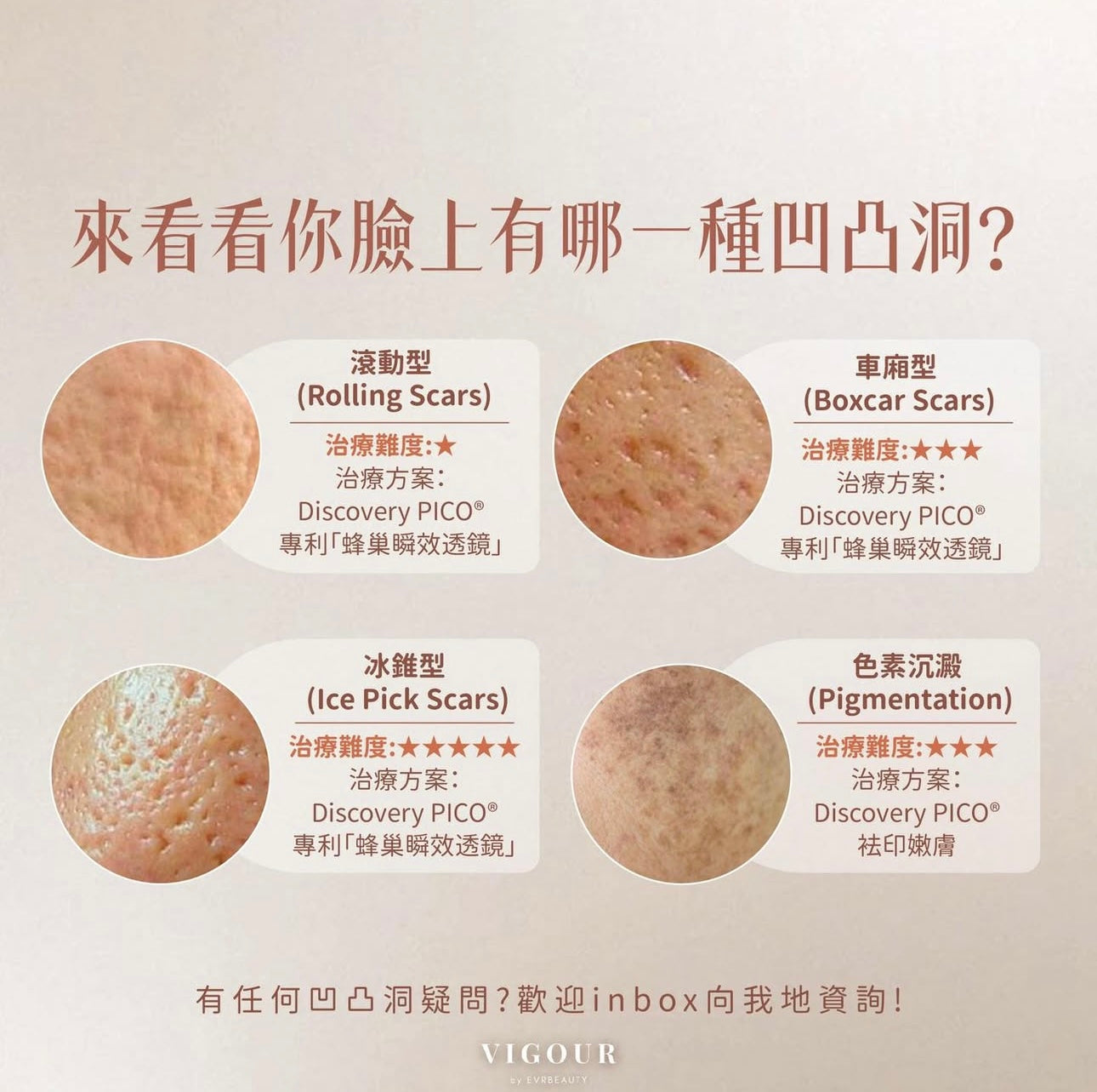 【新客限定】PICO DUAL皮秒蜂巢去除凹凸洞療程