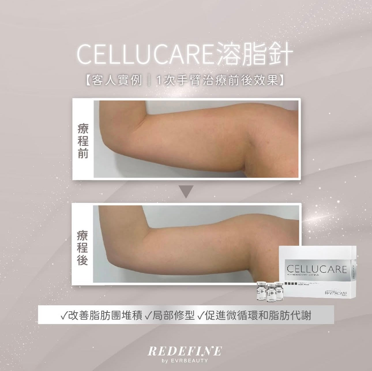 【新客限定】CELLUCARE®溶脂針