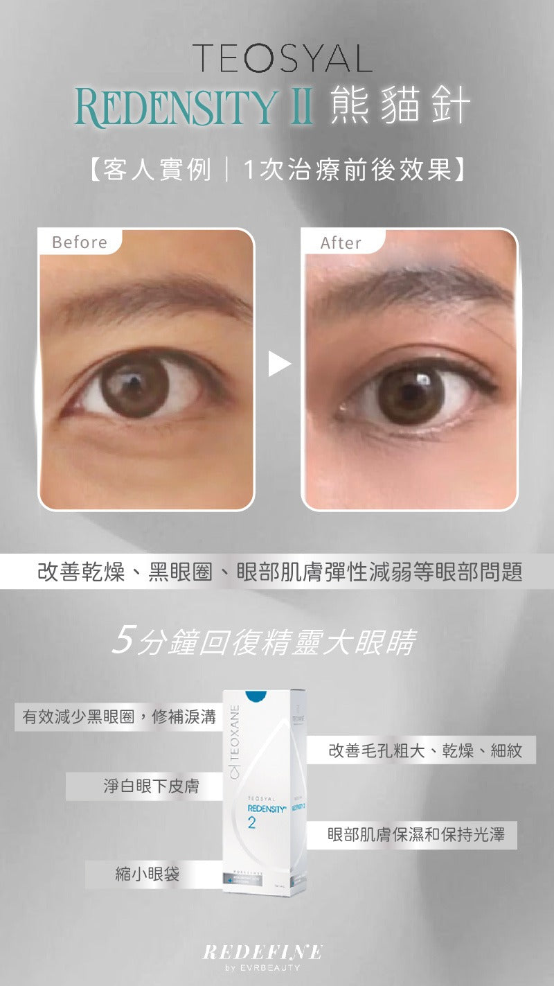 【新客限定】REDENSITY II 熊貓針® 1ml