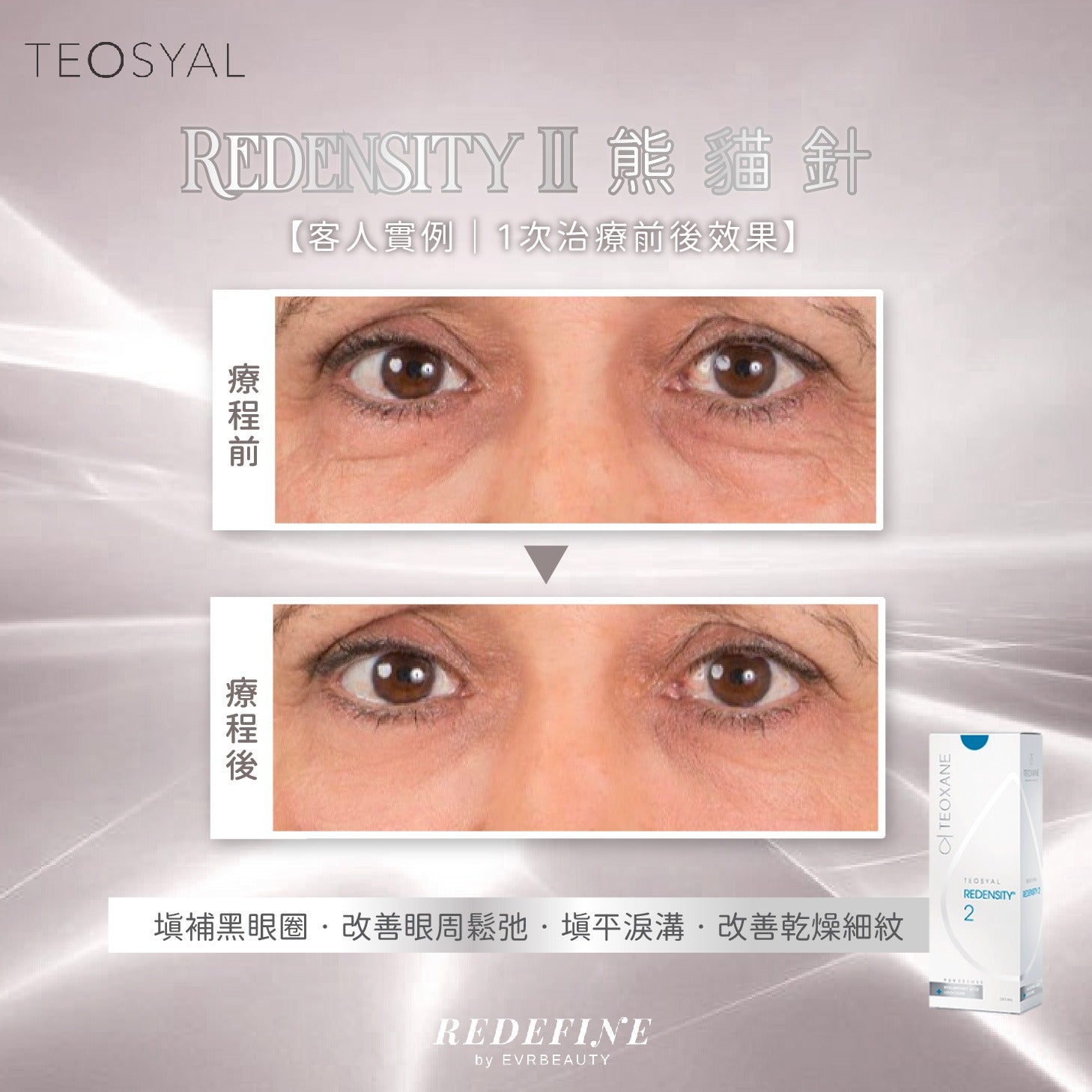 【新客限定】REDENSITY II 熊貓針® 1ml