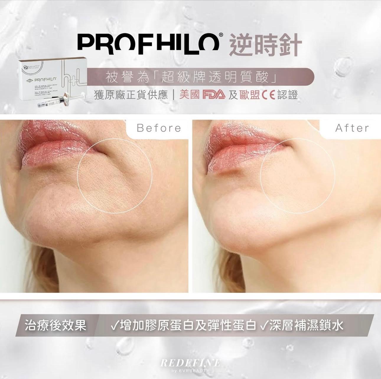 【新客限定】PROFHILO®逆時針 2ml