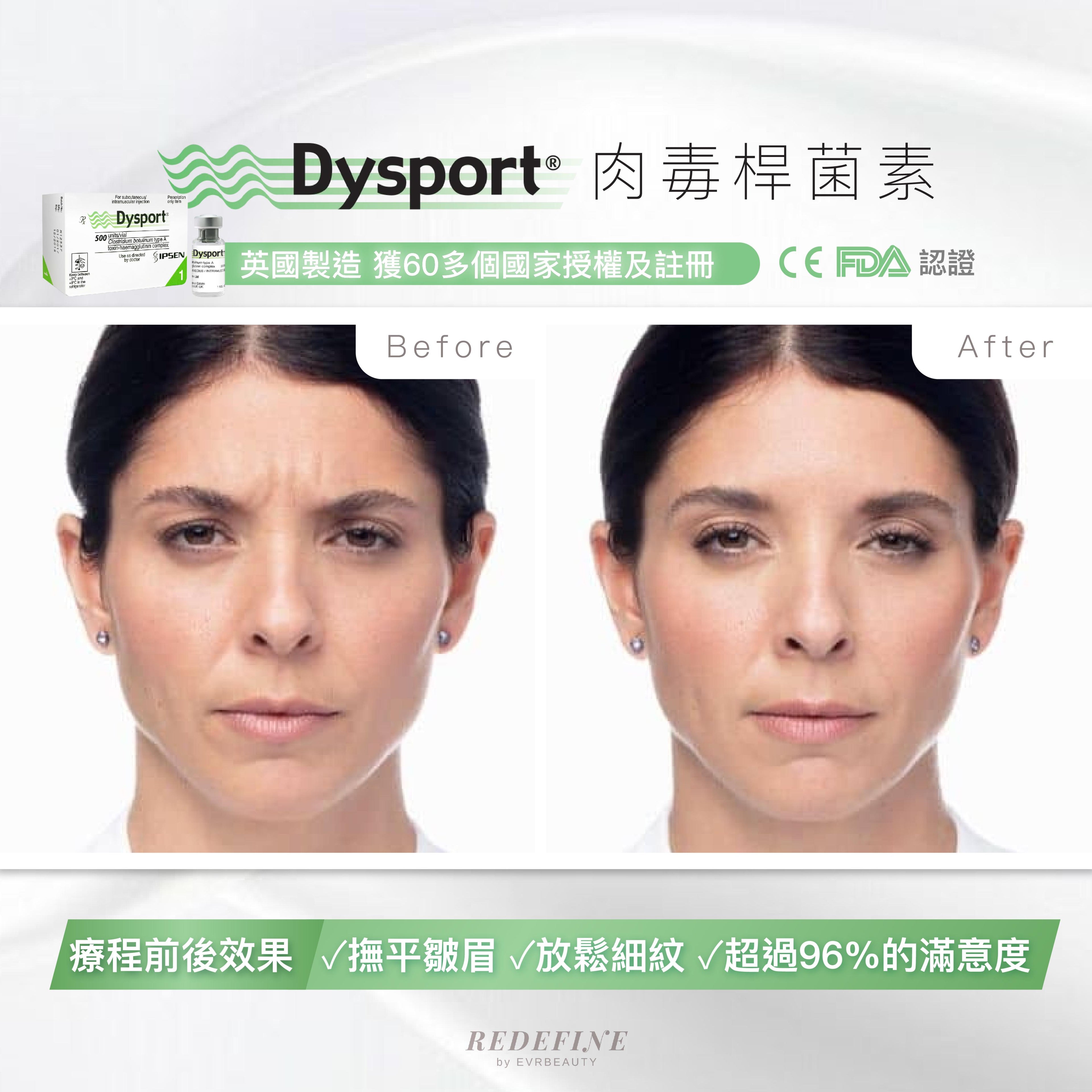 【新客限定】Dysport® 肉毒桿菌素