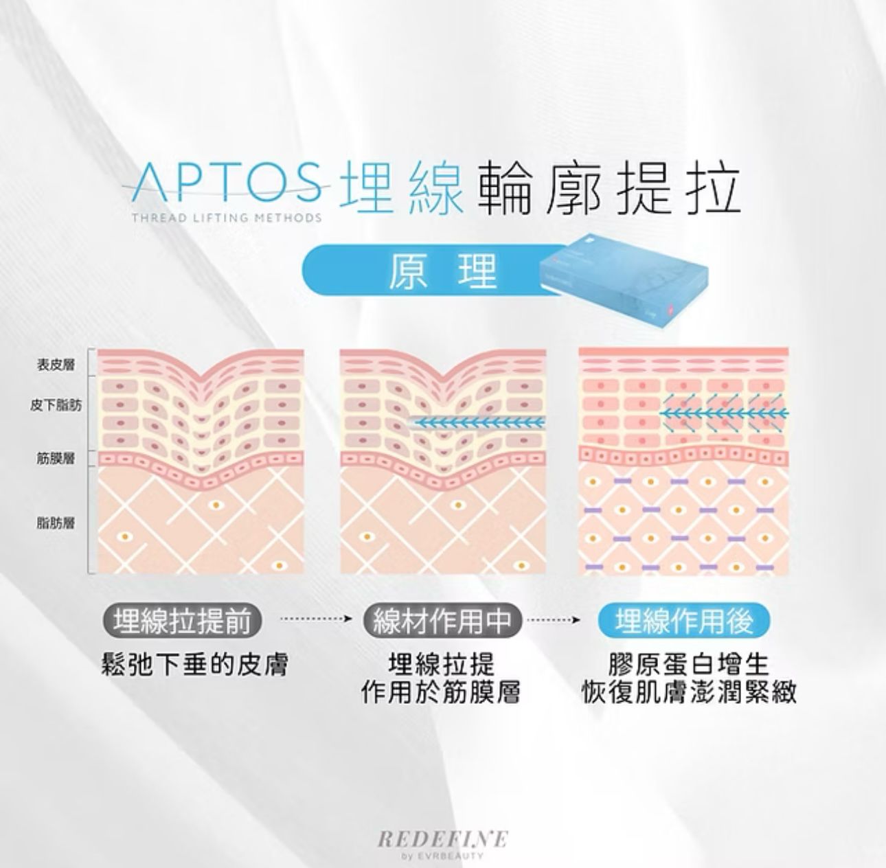 【新客限定】APTOS 埋線輪廓提拉 10線