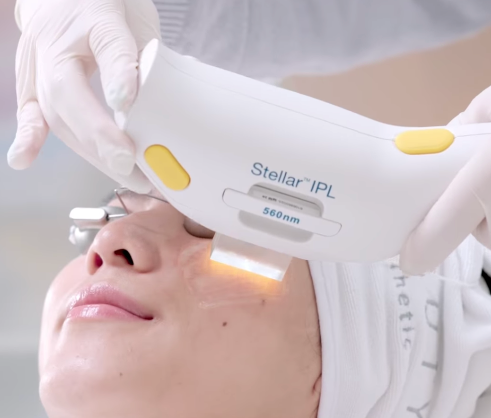 【新客優惠】醫療版Stellar M22 超脈衝激光