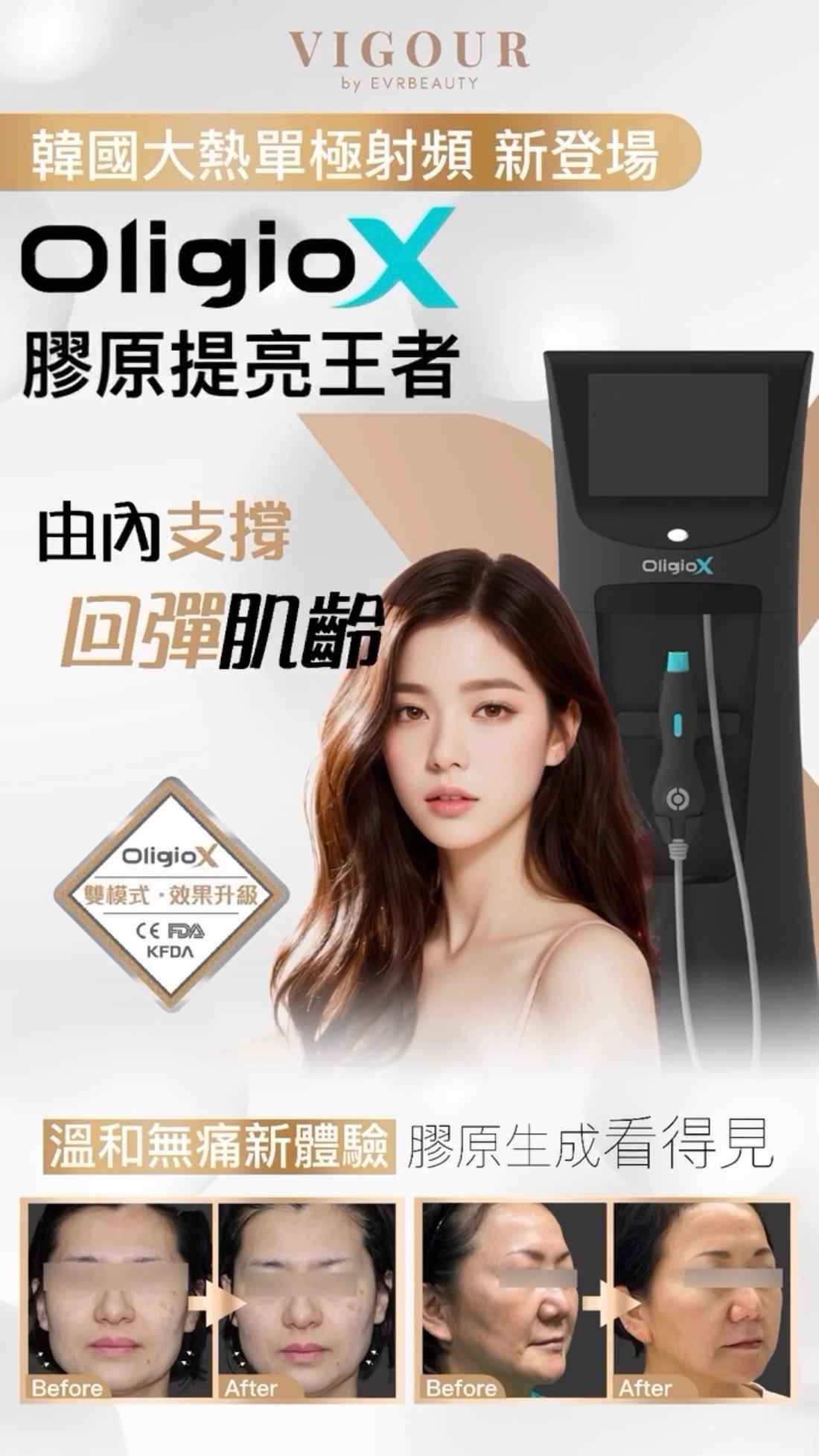 【New Customers Only】EXILIS ULTRA 360™ Upgrade Collagen Eye Bag Gun