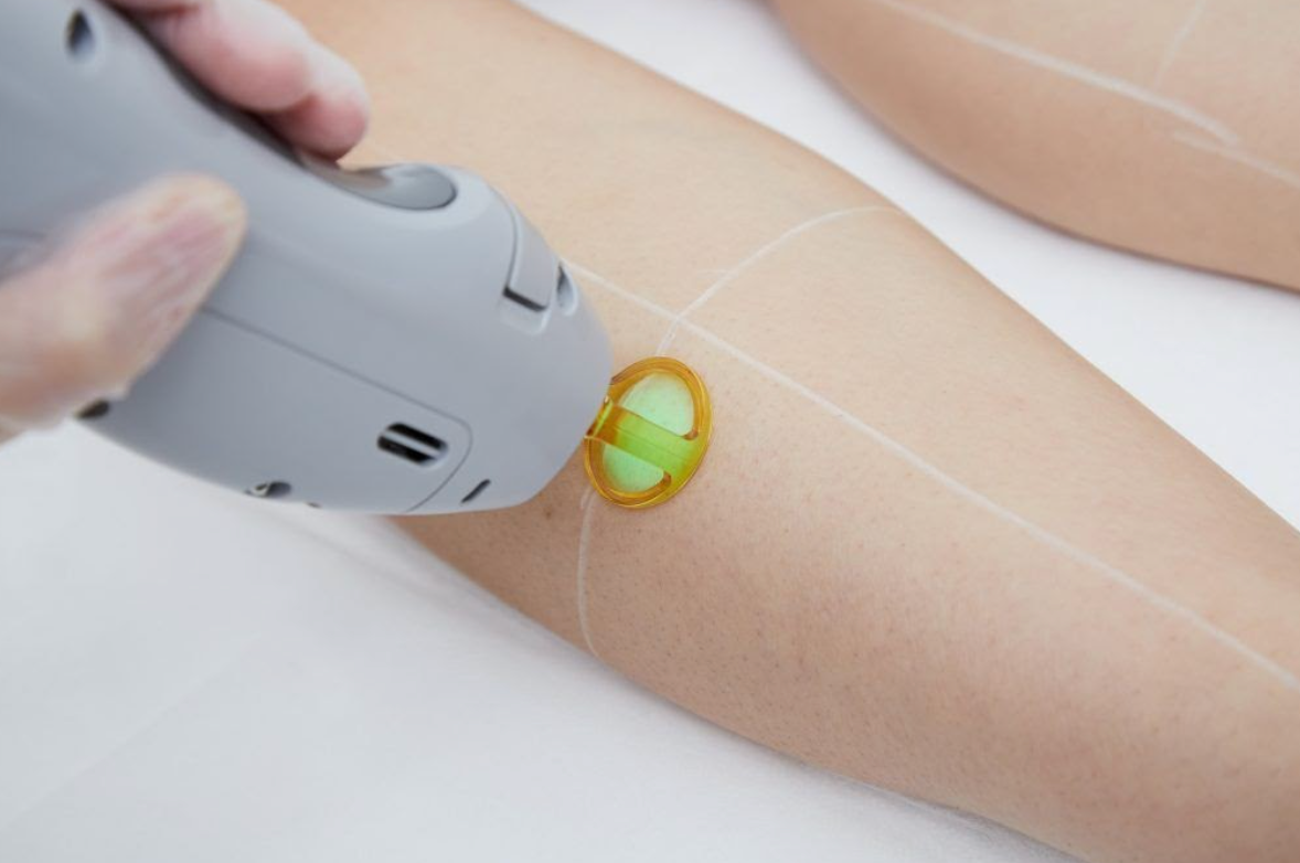 【New customers only】Axillary Hair Removal Laser Hair Removal
